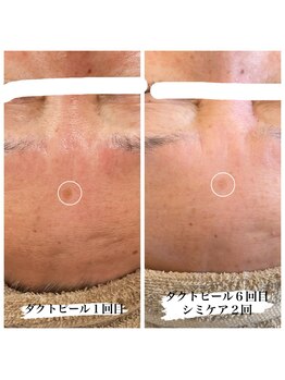 エメリア(Emelia)/