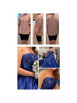 パワーパステル/ブライダルエステ【施術前後】