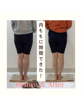 スタイルラボ高松/産後の骨盤矯正の効果♪