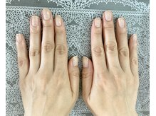 桃の木 吉祥寺店/20代ネイルケアafter 