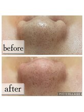 パル(PAL)/ビフォーアフター