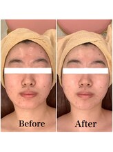 スペチアーレ 夙川/小顔も美肌も手に入る