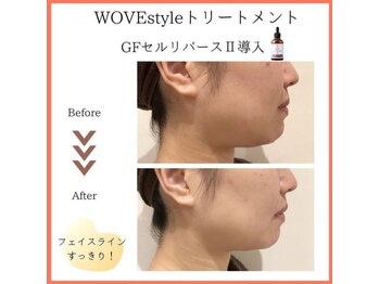 サロンドゥレーヴシエル(Salon de reve Ciel...)/【WOVEstyle】トリートメント