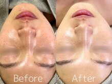 マイナプラ 表参道(myna+)/