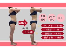 エステティック レイビス 八戸店(RAYVIS)