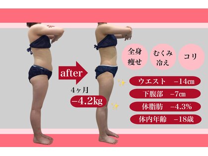 エステティック レイビス 八戸店(RAYVIS)の写真