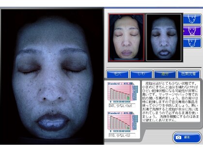 ベティ アンド ボーテの写真