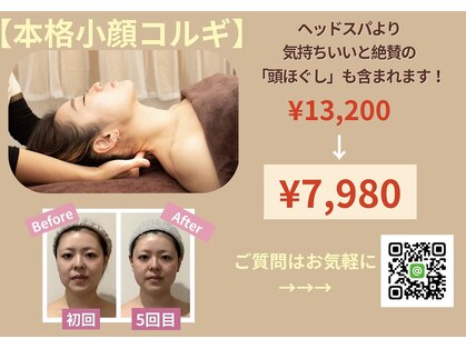 レアフィート(Rheafeet)の写真