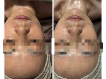 アジュール(azure)/夏の疲れをリセット