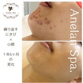 アネランスパ(Anelan Spa.)