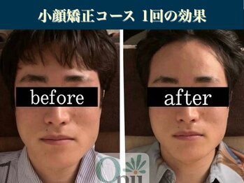 キュープ 表参道店(Qpu)/継続が「小顔」と「美」をつくる