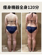 リア(Lia)/50代女性月1回のメンテナンスで