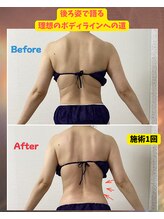 チャルメ/完全オーダーメイド60分