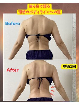 チャルメ/完全オーダーメイド60分【40代】