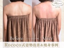 ロココ 水戸店(Rococo)/BEFORE/AFTER