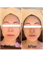 スペチアーレ 夙川/激的な引き上がり