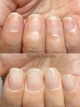 マリーロール 淀屋橋本店(Marie Laure)/自爪育成/深爪矯正/ネイルケア