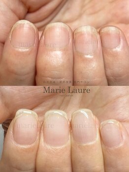 マリーロール 淀屋橋本店(Marie Laure)/自爪育成/深爪矯正/ネイルケア