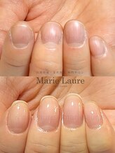マリーロール 梅田店(Marie Laure)/深爪矯正/自爪育成/自爪風