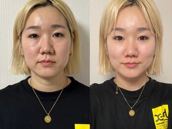 ファソ ブロウアンドアイズ(fasol)の写真/気になる眉の左右差を表情筋から整えて美眉×小顔へ