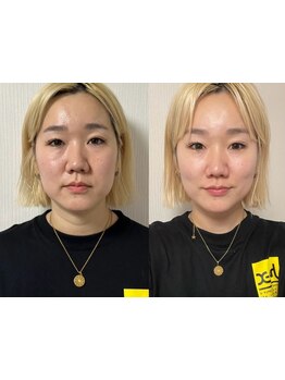 アイブロウメニューがあるサロン