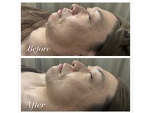 白美/メンズもおすすめ！小顔矯正