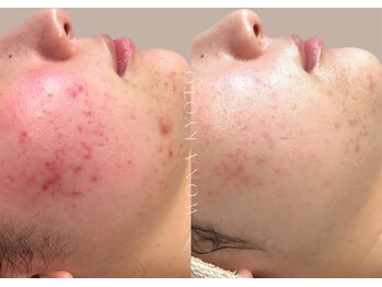 ウォナ(WONA)/【お客様症例】