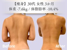 ベルペール(Belle perle)