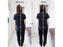 ジェイミープラス 表参道(J‘aimee +)/腰痛・歪み改善ビフォーアフター