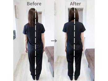 ジェイミープラス 表参道(J‘aimee +)/腰痛・歪み改善ビフォーアフター