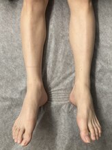 ヴィプラス(VIPLUZ)/学割U２４で、学割脱毛☆