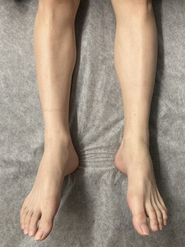 ヴィプラス(VIPLUZ)/学割U２４で、学割脱毛☆