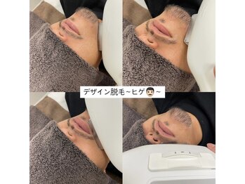 カルディエ(Cardie)/ひげデザイン脱毛