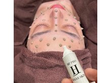 ビューティースタイリング 恵比寿店(beauty styling)/【新】エピダーマルスキン