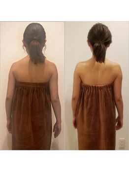 トータルエステティック ジョワイユ(JOYEUX)/集中ブライダルコース