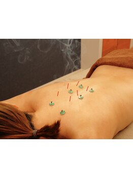 鍼灸施術を受けたい