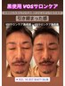 【メンズフェイシャル】ニキビケア・毛穴ケア・リフトアップ☆肌質改善.VOS