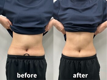 モア 札幌平岸店(MORE)/ブライダル直前でもウェルカム