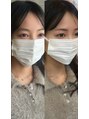 リンクビーワクシング(LINK B WAXING)&nbsp;HBLで眉癖改善をしてナチュラルふんわり眉もつくれます◎