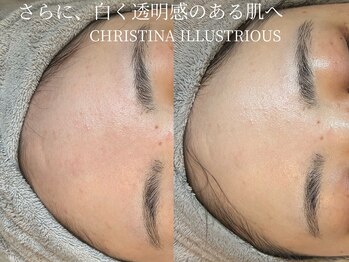 シェア(share.)/クリスティーナ　イラストリアス