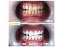 ルブラン 奈良店(Le Blanc)/縛りのないコースで確実に白く