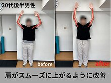 アオ整体院/両肩の可動域が驚くほど改善！