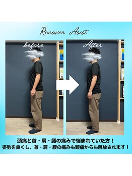 リカバーアシスト(Recover Asist)/姿勢改善