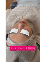 パタティパタタ(PatatiPatata)/ク◯ニックの3倍のヒト幹細胞