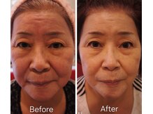 リラクゼーションステイ サクラ(SAKURA)/