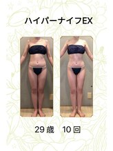 ベルシア 吉祥寺店(BELCIA)/ハイパーナイフEX/ダイエット