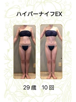 ベルシア 吉祥寺店(BELCIA)/ハイパーナイフEX/ダイエット