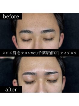 ユー 千葉駅前店(you)/ビフォ－アフター写真