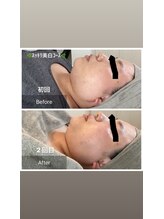 ソルーチェ(soluce)/定期的なお手入れで、、、