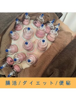 いつつのき/カッピング（吸い玉）